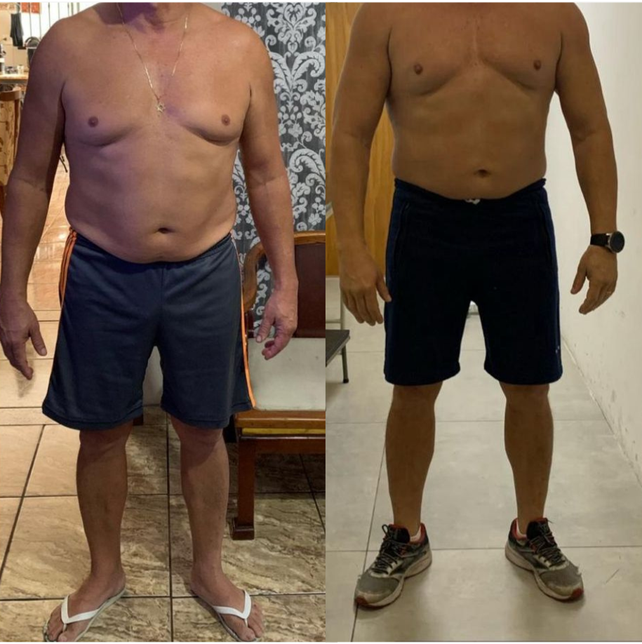 Transformação: 2 meses de tratamento