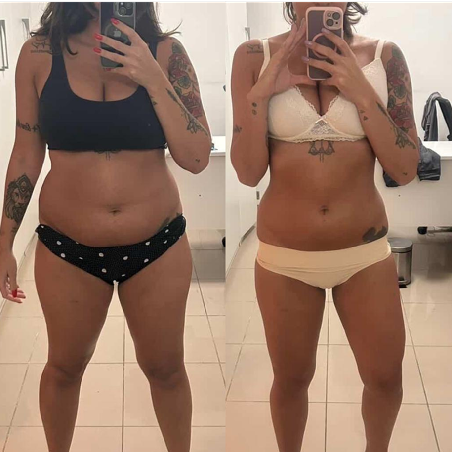 Transformação: 3 meses de tratamento