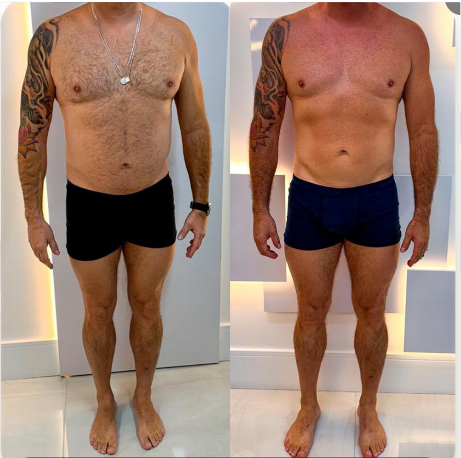 Transformação: 4 meses de tratamento
