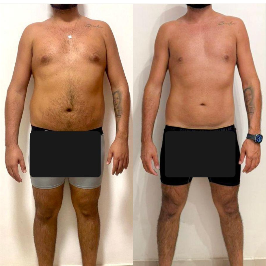 Transformação: 6 meses de tratamento