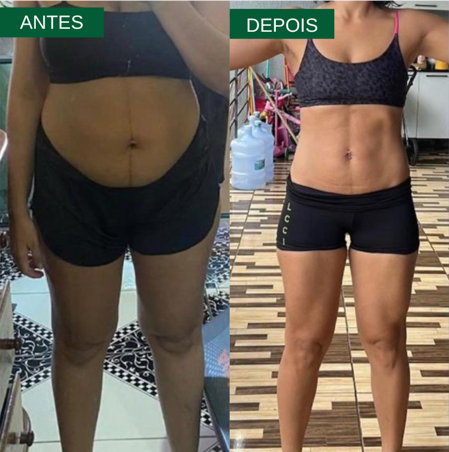Antes e depois – caso 3