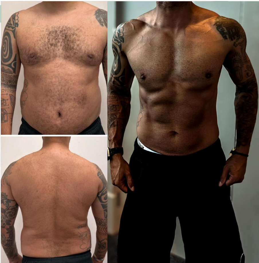 Antes e depois – caso 5