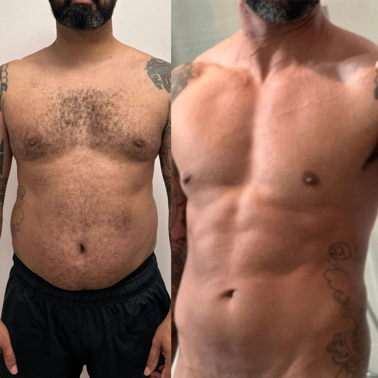 Transformação de paciente – foto 1