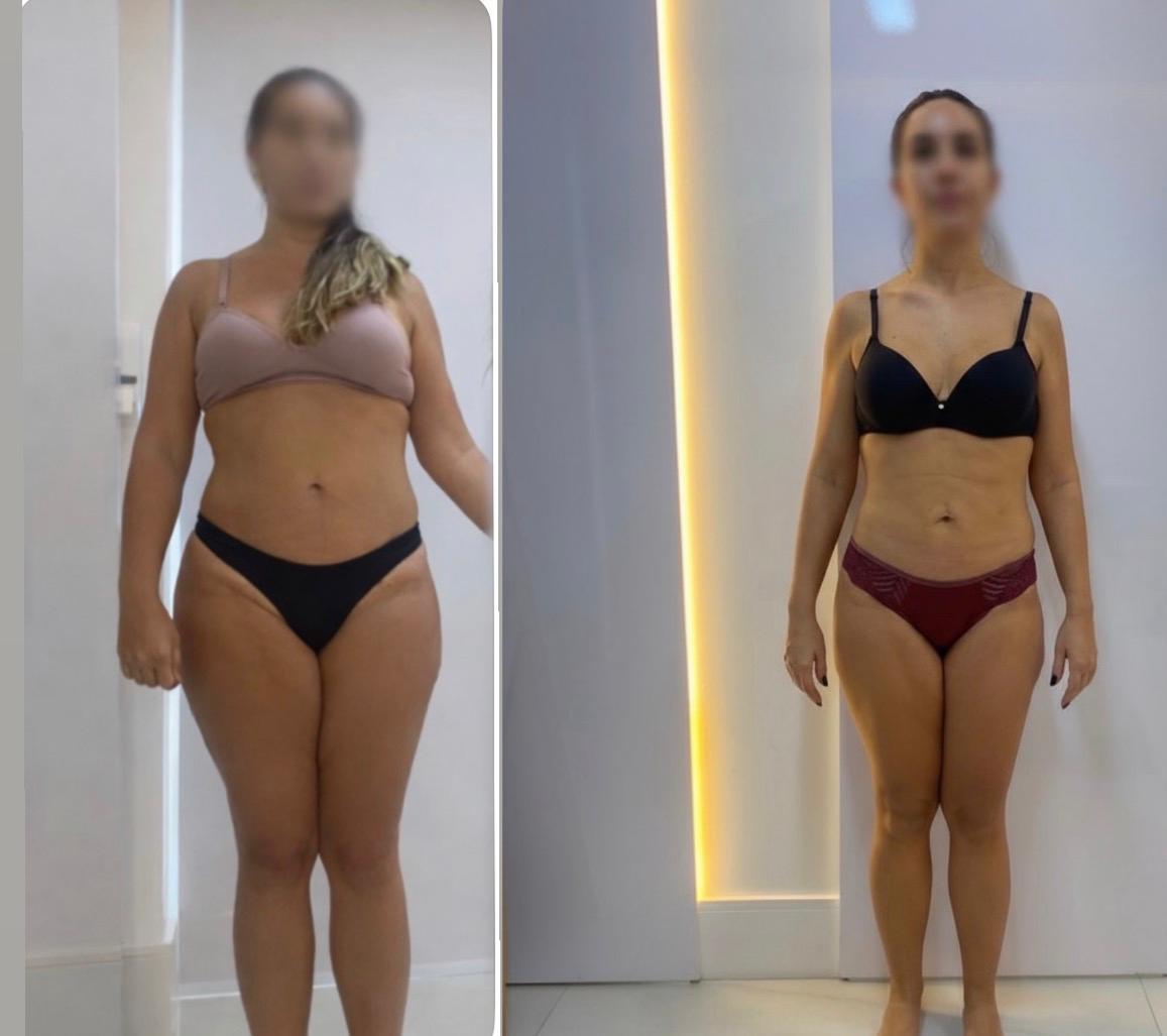 Transformação de paciente – foto 6