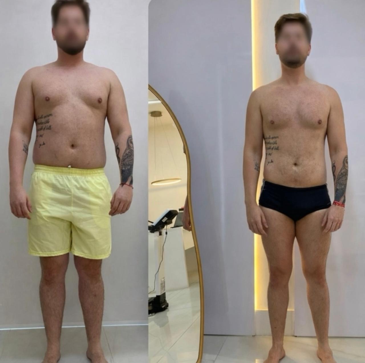 Transformação de paciente – foto 16